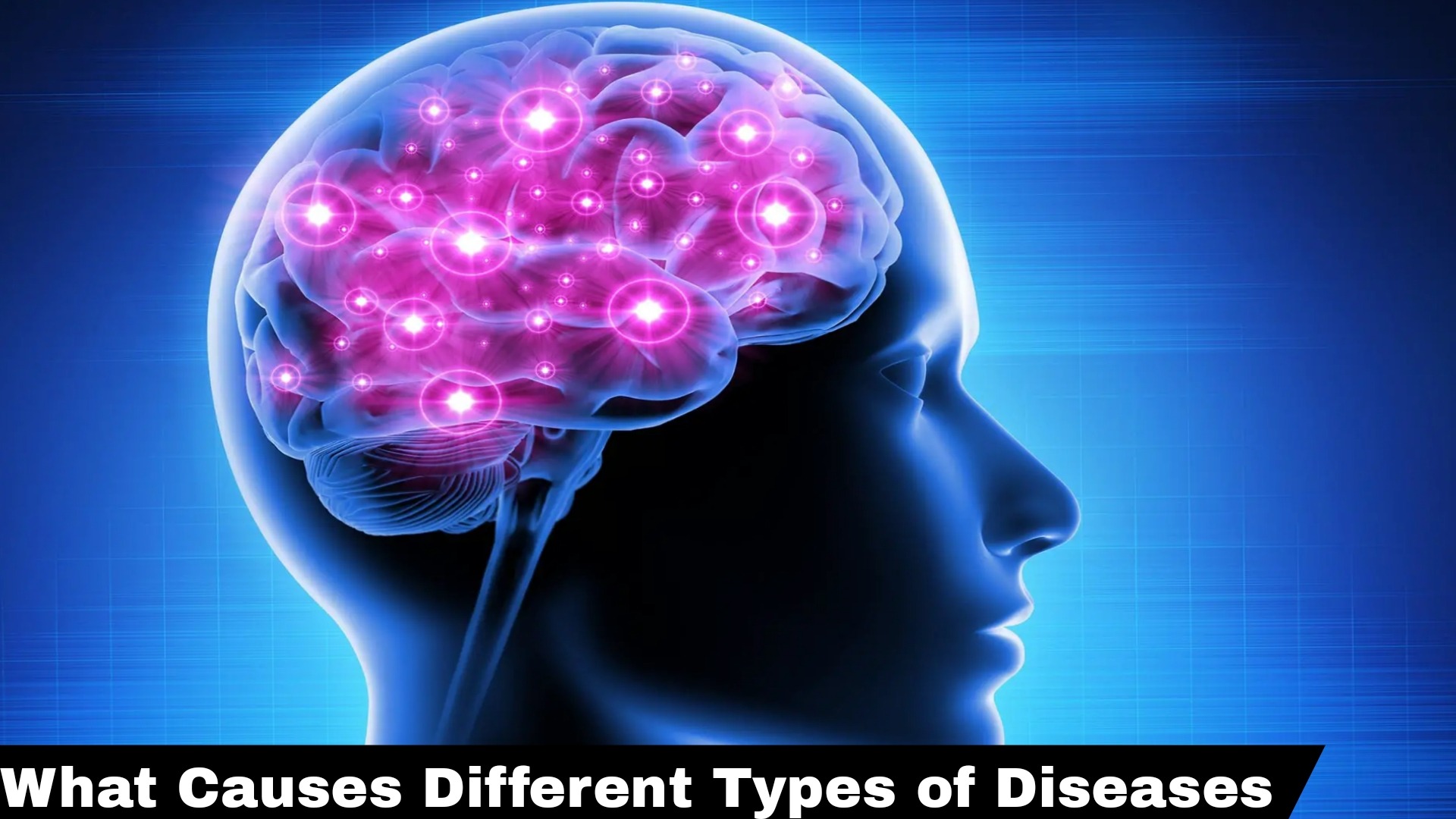 Infection in the Brain: What Causes Different Types of Diseases